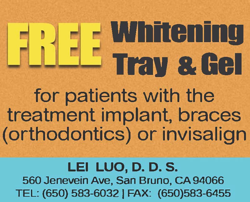 Free Whitening Tray & Gel